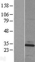 MBLAC2 Protein - Western validation with an anti-DDK antibody * L: Control HEK293 lysate R: Over-expression lysate