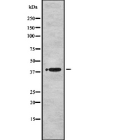 MBNL1 / MBNL Antibody - Western blot analysis of MBNL1 using HuvEc whole cells lysates
