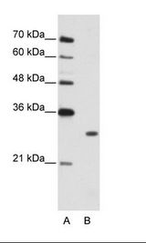 MBNL1 / MBNL Antibody - B: Jurkat Cell Lysate.  This image was taken for the unconjugated form of this product. Other forms have not been tested.