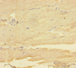 MBNL1 / MBNL Antibody - Immunohistochemistry of paraffin-embedded human skeletal muscle tissue using MBNL1 Antibody at dilution of 1:100