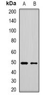 MBNL1 / MBNL Antibody - Western blot analysis of MBNL1 expression in HepG2 (A); MCF7 (B) whole cell lysates.