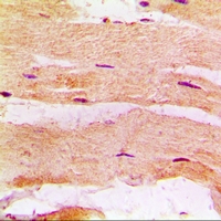 MBNL1 / MBNL Antibody - Immunohistochemical analysis of MBNL1 staining in rat heart formalin fixed paraffin embedded tissue section. The section was pre-treated using heat mediated antigen retrieval with sodium citrate buffer (pH 6.0). The section was then incubated with the antibody at room temperature and detected using an HRP conjugated compact polymer system. DAB was used as the chromogen. The section was then counterstained with hematoxylin and mounted with DPX.