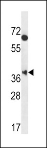 MBNL2 Antibody - MBNL2 Antibody western blot of HeLa cell line lysates (35 ug/lane). The MBNL2 antibody detected the MBNL2 protein (arrow).