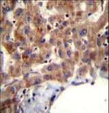 MBNL2 Antibody - MBNL2 Antibody immunohistochemistry of formalin-fixed and paraffin-embedded human liver tissue followed by peroxidase-conjugated secondary antibody and DAB staining.