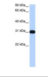 MBNL2 Antibody - Fetal brain cell lysate. Antibody concentration: 0.5 ug/ml. Gel concentration: 12%.  This image was taken for the unconjugated form of this product. Other forms have not been tested.