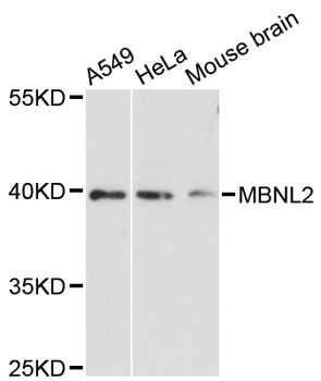 MBNL2 Antibody - Western blot analysis of extracts of various cell lines, using MBNL2 antibody at 1:3000 dilution. The secondary antibody used was an HRP Goat Anti-Rabbit IgG (H+L) at 1:10000 dilution. Lysates were loaded 25ug per lane and 3% nonfat dry milk in TBST was used for blocking. An ECL Kit was used for detection and the exposure time was 90s.