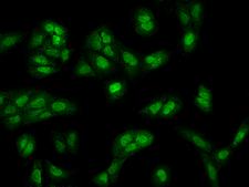 MBNL2 Antibody - Immunofluorescence staining of MBNL2 in U2OS cells. Cells were fixed with 4% PFA, permeabilzed with 0.3% Triton X-100 in PBS, blocked with 10% serum, and incubated with rabbit anti-Human MBNL2 polyclonal antibody (dilution ratio 1:100) at 4°C overnight. Then cells were stained with the Alexa Fluor 488-conjugated Goat Anti-rabbit IgG secondary antibody (green). Positive staining was localized to Nucleus and Cytoplasm.