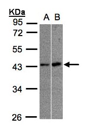 MBNL3 Antibody - Sample (30 ug whole cell lysate). A: A431, B: Raji . 10% SDS PAGE. MBNL3 antibody diluted at 1:1000