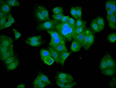 MBNL3 Antibody - Immunofluorescence staining of HepG2 cells diluted at 1:133, counter-stained with DAPI. The cells were fixed in 4% formaldehyde, permeabilized using 0.2% Triton X-100 and blocked in 10% normal Goat Serum. The cells were then incubated with the antibody overnight at 4°C.The Secondary antibody was Alexa Fluor 488-congugated AffiniPure Goat Anti-Rabbit IgG (H+L).