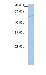 MBOAT1 Antibody - Jurkat cell lysate. Antibody concentration: 1.0 ug/ml. Gel concentration: 12%.  This image was taken for the unconjugated form of this product. Other forms have not been tested.