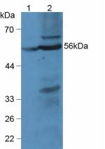 MBOAT5 / C3F Antibody - Western Blot; Sample: Lane1: Rat Liver Tissue; Lane2: Mouse Liver Tissue.