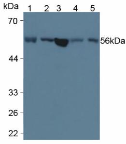 MBOAT5 / C3F Antibody - Western Blot; Sample: Human Serum; Lane2: Porcine Liver Tissue; Lane3: Human Liver Tissue; Lane4: Porcine Pancreas Tissue; Lane5: Porcine Kidney Tissue.