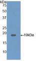 MBOAT5 / C3F Antibody - Western Blot; Sample: Recombinant LPCAT3, Human.