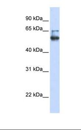 MBOAT7 / BB1 Antibody - Fetal brain lysate. Antibody concentration: 1.0 ug/ml. Gel concentration: 12%.  This image was taken for the unconjugated form of this product. Other forms have not been tested.