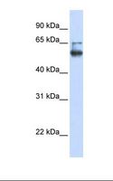 MBOAT7 / BB1 Antibody - Fetal brain lysate. Antibody concentration: 1.0 ug/ml. Gel concentration: 12%.  This image was taken for the unconjugated form of this product. Other forms have not been tested.