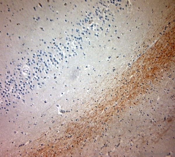 MBP / Maltose Binding Protein Antibody - Rabbit antibody to MBP (180-220). IHC-P on paraffin sections of human brain, hippocampus. HIER: Tris-EDTA, pH 9 for 20 min using Thermo PT Module. Blocking: 0.2% LFDM in TBST filtered through a 0.2 micron filter. Detection was done using Novolink HRP polymer from Leica following manufacturers instructions. Primary antibody: dilution 1:1000, incubated 30 min at RT using Autostainer. Sections were counterstained with Harris Hematoxylin.