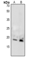 MBP / Maltose Binding Protein Antibody - Western blot analysis of MBP (pT232) expression in mouse brain (A), rat brain (B) whole cell lysates.