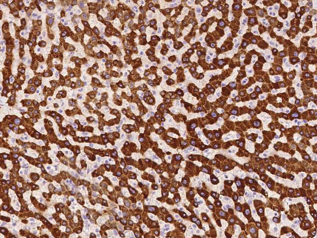 MBP / Maltose Binding Protein Antibody - Immunochemical staining of human MBL2 in human liver with rabbit polyclonal antibody at 1:500 dilution, formalin-fixed paraffin embedded sections.
