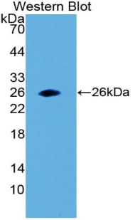 MBP / Myelin Basic Protein Antibody - Western blot of recombinant Myelin Basic Protein / MBP.