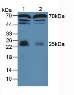 MBP / Myelin Basic Protein Antibody - Western Blot; Sample: Lane1: Mouse Brain Tissue; Lane2: Rat Brain Tissue.