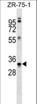 MBP / Myelin Basic Protein Antibody - MBP Antibody (Ascites)western blot of ZR-75-1 cell line lysates (35 ug/lane). The MBP antibody detected the MBP protein (arrow).