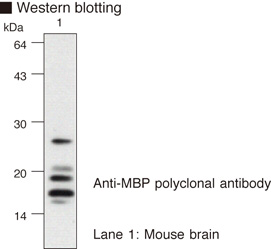 MBP / Myelin Basic Protein Antibody