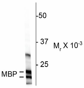 MBP / Myelin Basic Protein Antibody - Western Blot of MBP antibody. Western blot of rat cortex homogenate showing specific immunolabeling of ~ 18 and 22k MBP protein