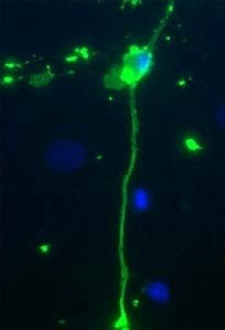 MBP / Myelin Basic Protein Antibody - Immunofluorescent staining using MBP antibody. Rat mixed neuron/glial cultures stained with chicken anti-Myelin Basic Protein (green). Blue is a DNA stain