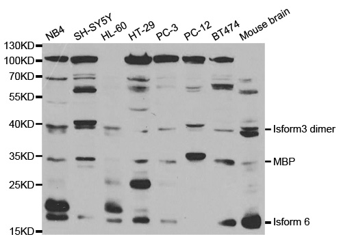 MBP / Myelin Basic Protein Antibody - Western blot analysis of extracts of various cell lines, using MBP antibody at 1:1000 dilution. The secondary antibody used was an HRP Goat Anti-Rabbit IgG (H+L) at 1:10000 dilution. Lysates were loaded 25ug per lane and 3% nonfat dry milk in TBST was used for blocking.