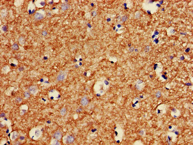 MBP / Myelin Basic Protein Antibody - Immunohistochemistry Dilution at 1:400 and staining in paraffin-embedded human brain tissue performed on a Leica BondTM system. After dewaxing and hydration, antigen retrieval was mediated by high pressure in a citrate buffer (pH 6.0). Section was blocked with 10% normal Goat serum 30min at RT. Then primary antibody (1% BSA) was incubated at 4°C overnight. The primary is detected by a biotinylated Secondary antibody and visualized using an HRP conjugated SP system.