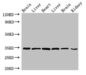 MBP / Myelin Basic Protein Antibody - Western Blot Positive WB detected in:Rat brain tissue,Rat liver tissue,Mouse heart tissue,Mouse liver tissue,Mouse brain tissue,Mouse kidney tissue All Lanes:MBP antibody at 4µg/ml Secondary Goat polyclonal to rabbit IgG at 1/50000 dilution Predicted band size: 34,22,21,19,18 KDa Observed band size: 34 KDa