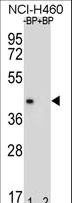 MBP / Myelin Basic Protein Antibody - Western blot of anti-MBP Antibody (Y203) in NCI-H460 cell line lysates (35 ug/lane). MBP(arrow) was detected using the purified antibody.