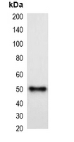 MBP Tag Antibody - Western blot analysis of over-expressed MBP-tagged protein in 293T cell lysate.
