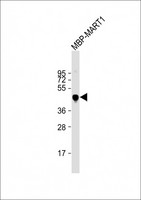 MBP Tag Antibody - Anti-MBP tag Antibody at 1:2000 dilution + Recombinant MBP MART1 lysate Lysates/proteins at 20 µg per lane. Secondary Goat Anti-Rabbit IgG, (H+L), Peroxidase conjugated at 1/10000 dilution. Predicted band size: 43 kDa Blocking/Dilution buffer: 5% NFDM/TBST.