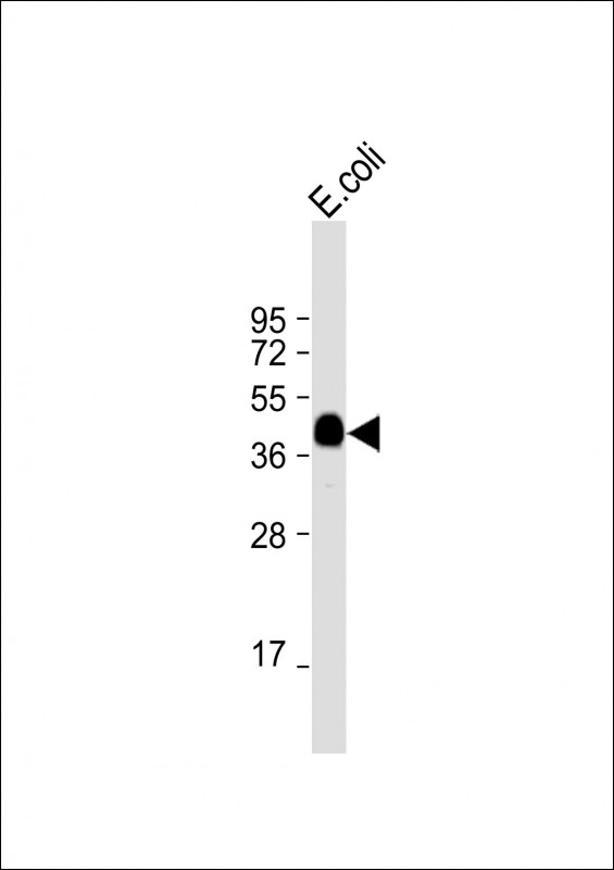 MBP Tag Antibody - Anti-MBP tag Antibody at 1:16000 dilution + E.coli lysate Lysates/proteins at 20 µg per lane. Secondary Goat Anti-Rabbit IgG, (H+L), Peroxidase conjugated at 1/10000 dilution. Predicted band size: 43 kDa Blocking/Dilution buffer: 5% NFDM/TBST.