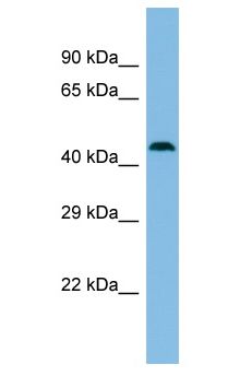 MBTD1 Antibody - MBTD1 antibody Western Blot of NCI-H226. Antibody dilution: 1 ug/ml.  This image was taken for the unconjugated form of this product. Other forms have not been tested.