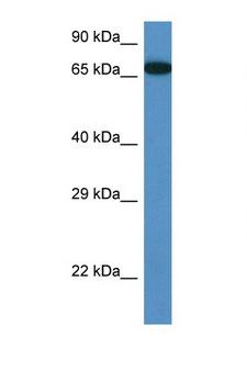 MBTD1 Antibody - MBTD1 antibody Western blot of Mouse Pancreas lysate. Antibody concentration 1 ug/ml.  This image was taken for the unconjugated form of this product. Other forms have not been tested.