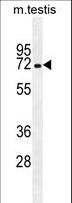 MBTD1 Antibody - MBTD1 Antibody western blot of mouse testis tissue lysates (35 ug/lane). The MBTD1 antibody detected the MBTD1 protein (arrow).