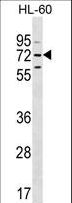 MBTD1 Antibody - MBTD1 Antibody western blot of HL-60 cell line lysates (35 ug/lane). The MBTD1 antibody detected the MBTD1 protein (arrow).