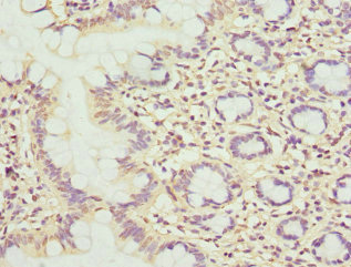 MBTPS1 / S1P Antibody - Immunohistochemistry of paraffin-embedded human small intestine at dilution 1:100