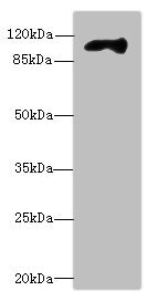 MBTPS1 / S1P Antibody - Western blot All Lanes: MBTPS1antibody at 4.06ug/ml+ Mouse kidney tissue Goat polyclonal to rabbit at 1/10000 dilution Predicted band size: 118 kDa Observed band size: 118 kDa