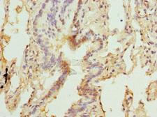 MBTPS1 / S1P Antibody - Immunohistochemistry of paraffin-embedded human lung tissue at dilution 1:100