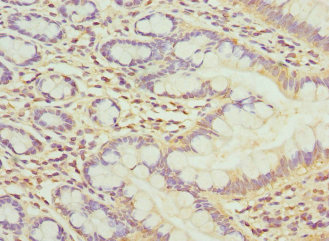 MBTPS1 / S1P Antibody - Immunohistochemistry of paraffin-embedded human small intestine at dilution 1:100