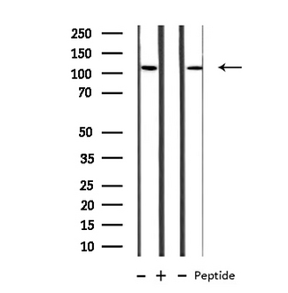 MBTPS1 / S1P Antibody - Western blot analysis of extracts of Jurkat/COLO205 cells using MBTPS1 antibody.