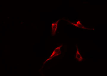 MBTPS1 / S1P Antibody - Staining HeLa cells by IF/ICC. The samples were fixed with PFA and permeabilized in 0.1% Triton X-100, then blocked in 10% serum for 45 min at 25°C. The primary antibody was diluted at 1:200 and incubated with the sample for 1 hour at 37°C. An Alexa Fluor 594 conjugated goat anti-rabbit IgG (H+L) antibody, diluted at 1/600, was used as secondary antibody.