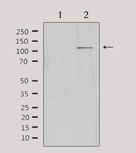 MBTPS1 / S1P Antibody - Western blot analysis of extracts of HeLa cells using MBTPS1 antibody. Lane 1 was treated with the antigen-specific peptide.
