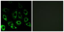 MBTPS2 Antibody - Immunofluorescence analysis of A549 cells, using MBTPS2 Antibody. The picture on the right is blocked with the synthesized peptide.