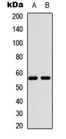 MBTPS2 Antibody - Western blot analysis of MBTPS2 expression in HEK293T (A); Raw264.7 (B) whole cell lysates.