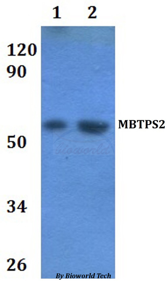 MBTPS2 Antibody - Western blot of MBTPS2 antibody at 1:500 dilution. Lane 1: HEK293T whole cell lysate. Lane 2: RAW264.7 whole cell lysate.