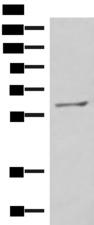 MBTPS2 Antibody - Western blot analysis of RAW264.7 cell lysate  using MBTPS2 Polyclonal Antibody at dilution of 1:800